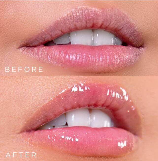 Healthy Lips Lip Plumper - Osmotics Skincare (White Background)