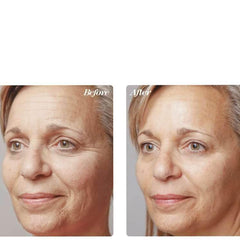 Renovage Longevity Serum - Osmotics Skincare