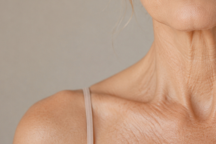 Crepey Neck and Chest: What Causes It and How to Smooth the Look