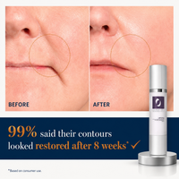 Lipofill Skin Firmness Restoration
