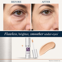 Concealer and So Much More