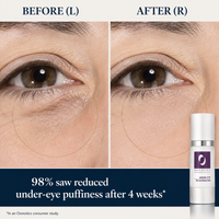 Under Eye Rejuvenator