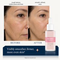 Retinol Serum