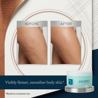 Blue Copper 5 Anti-Aging Body Lift