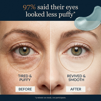 Rejuvenating Eye Gels
