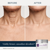 Nécolleté Age Reversal for Neck and Chest