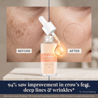 Vitamin C Serum