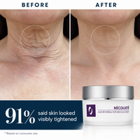 Nécolleté Age Reversal for Neck and Chest