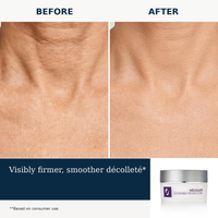 Nécolleté Age Reversal for Neck and Chest