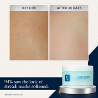 Blue Copper 5® Anti-Aging Body Lift