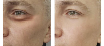 Blue Copper 5 Firming Eye Complex - Osmotics Skincare
