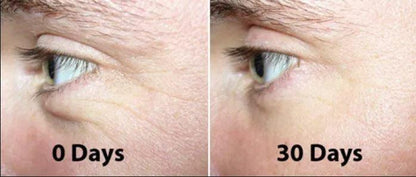R+R Longevity Eye Complex (Renovage + Retinol) - Osmotics Skincare